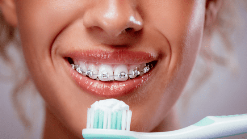 brushing teeth braces toothbrush